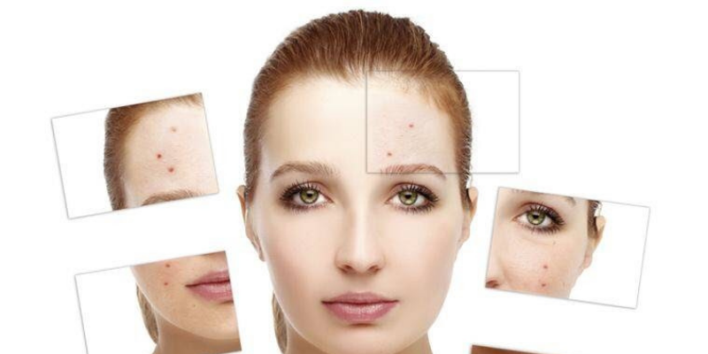 Anti-Aging Beauty Home Remedies To Get Rid Of Wrinkles And Fine Lines